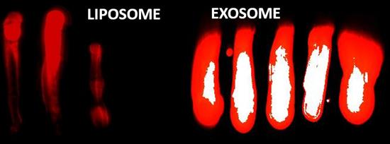 liposome-exosome